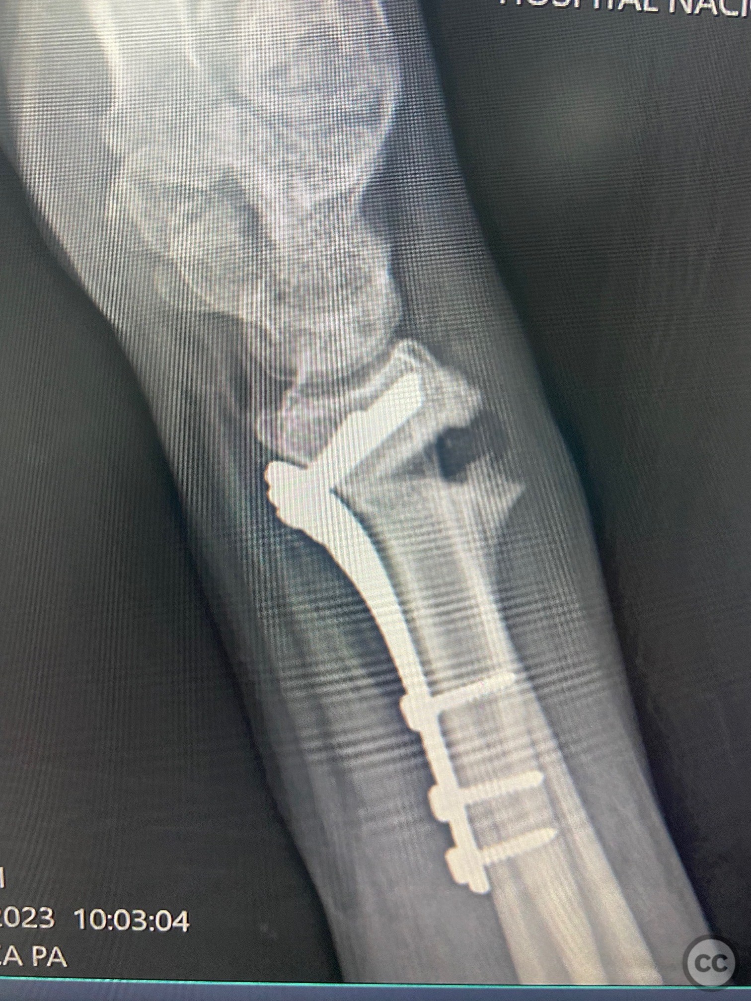 case image