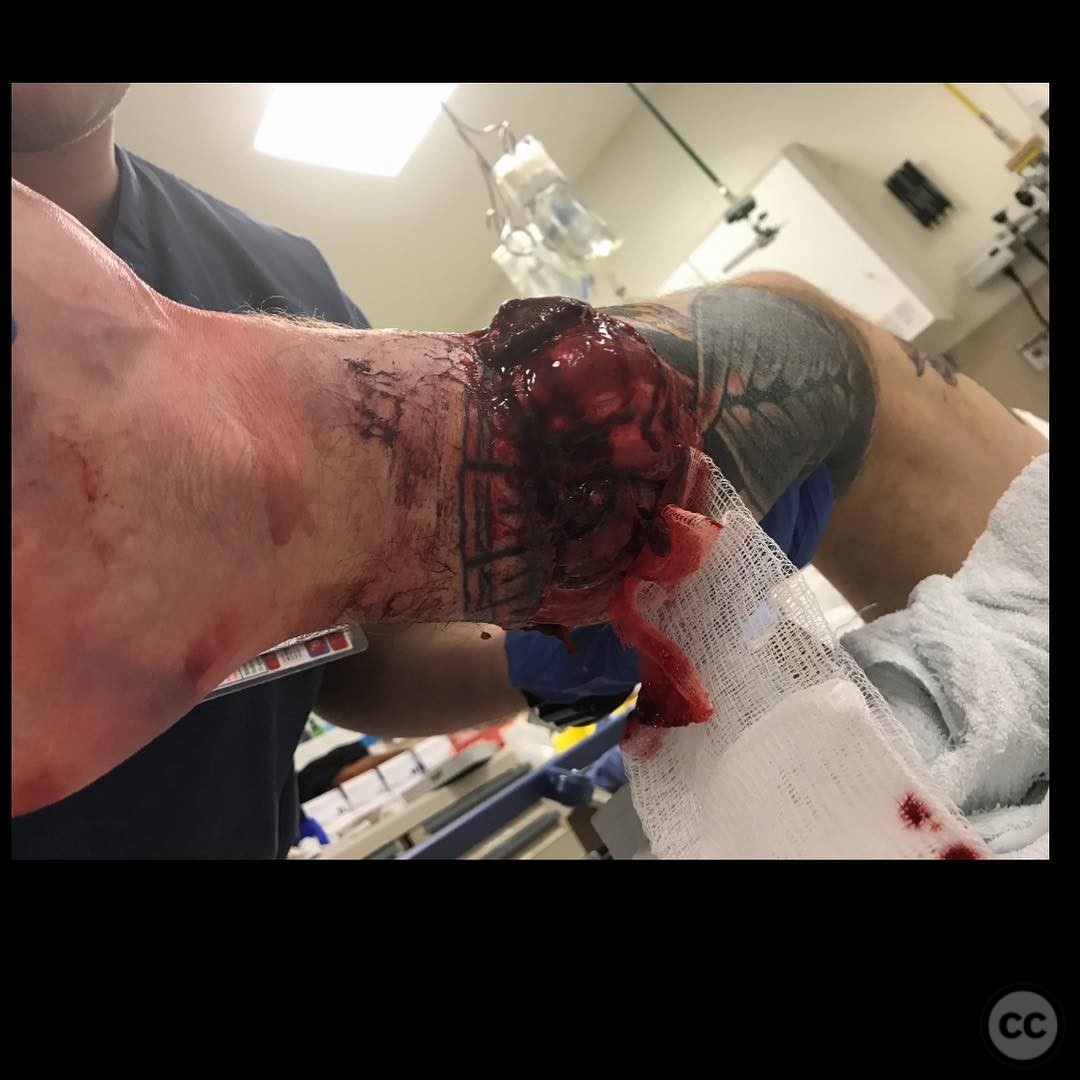 case image