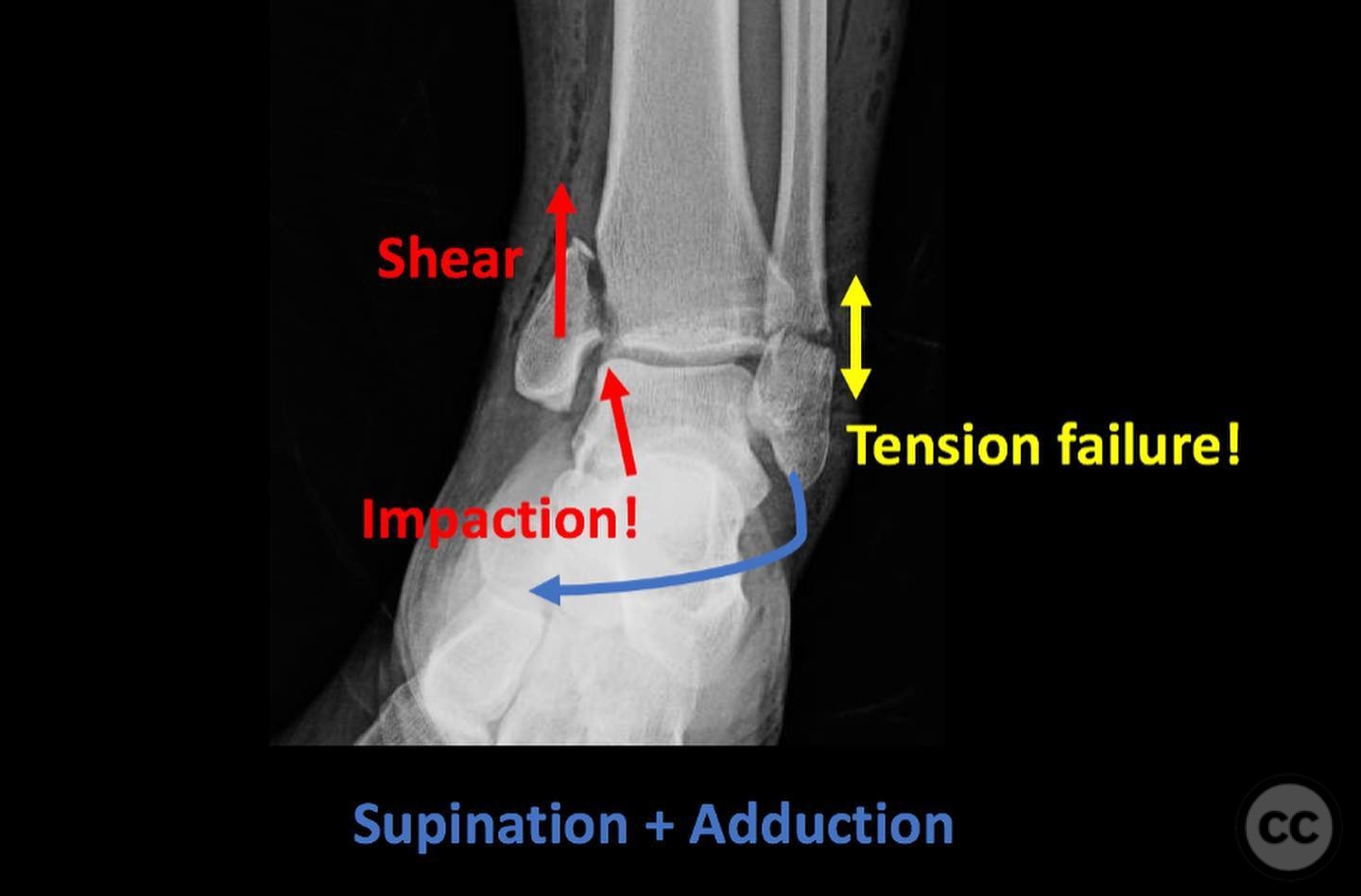 case image