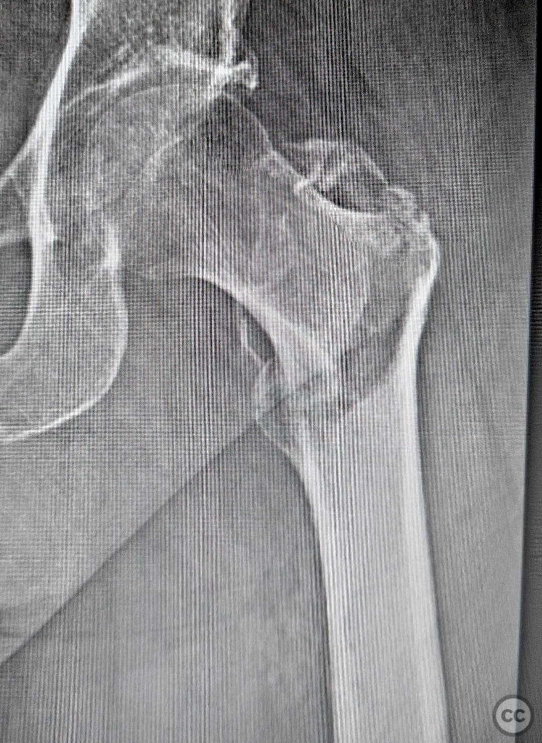 case image