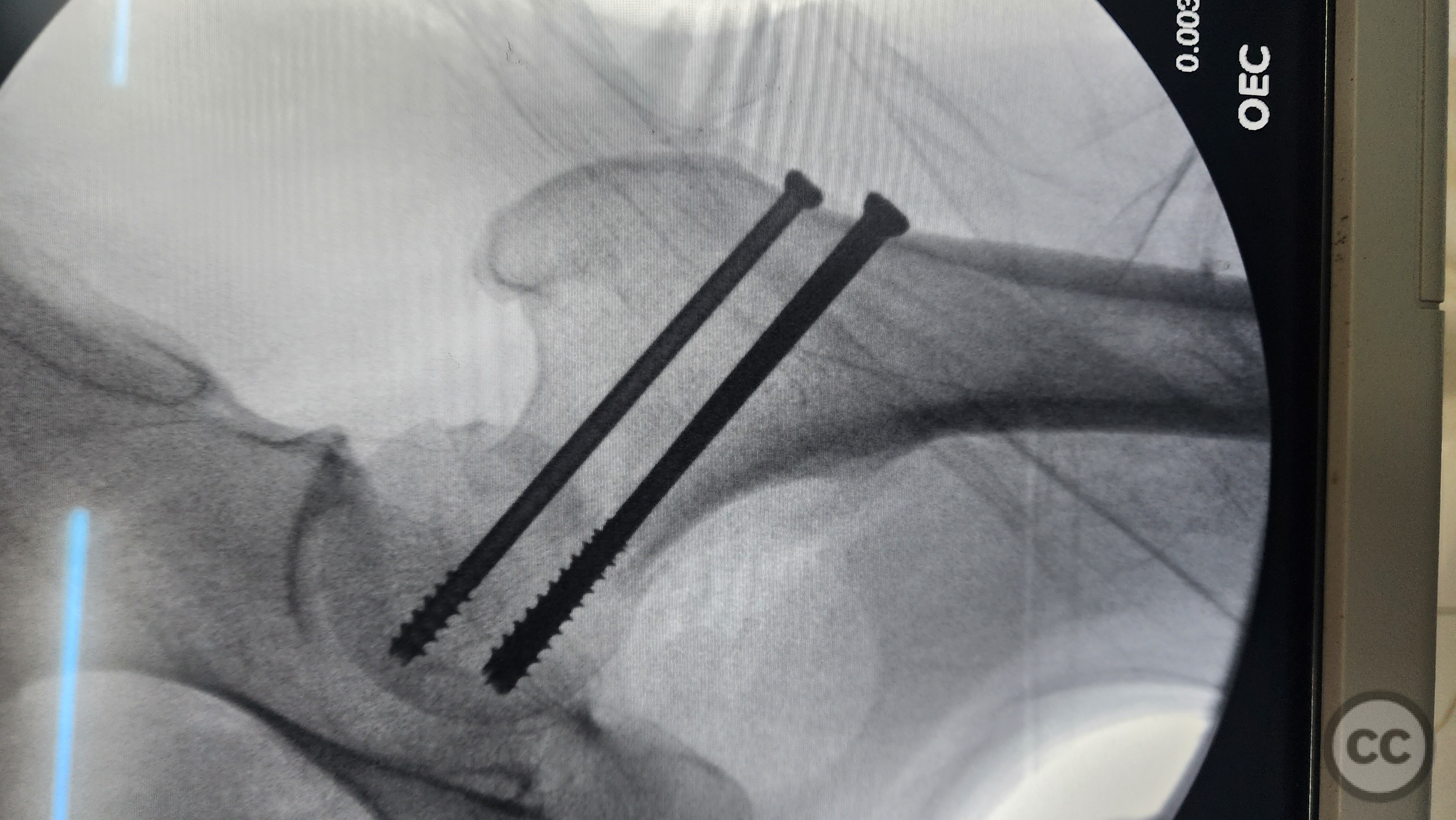 case image