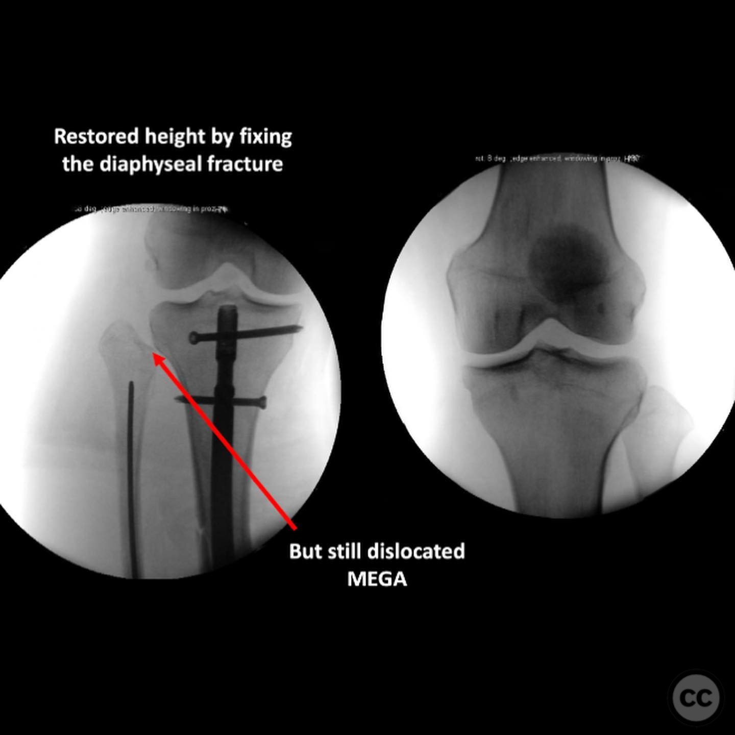 case image