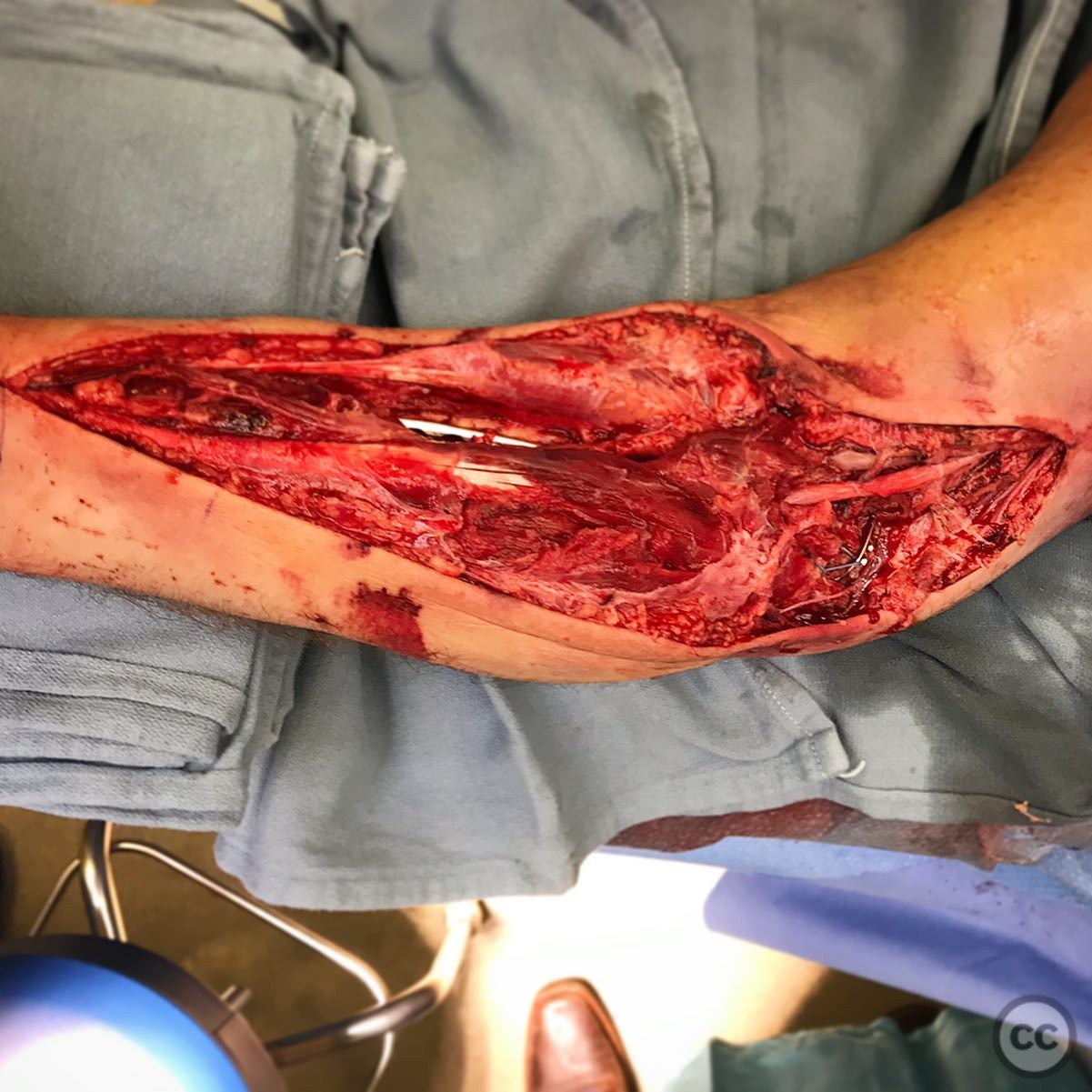 case image