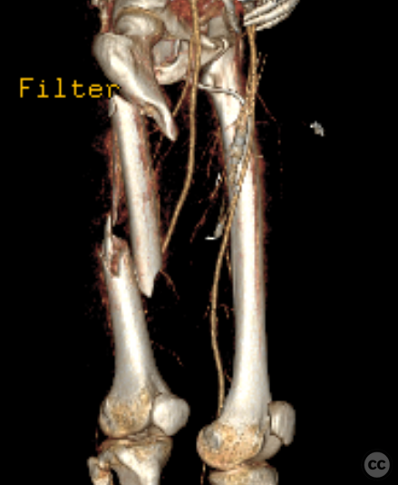 case image
