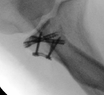 case image