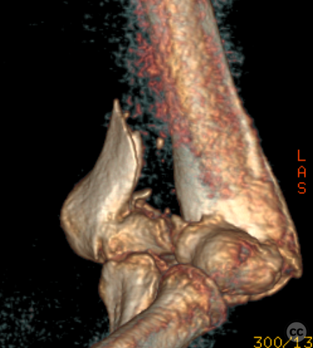 case image