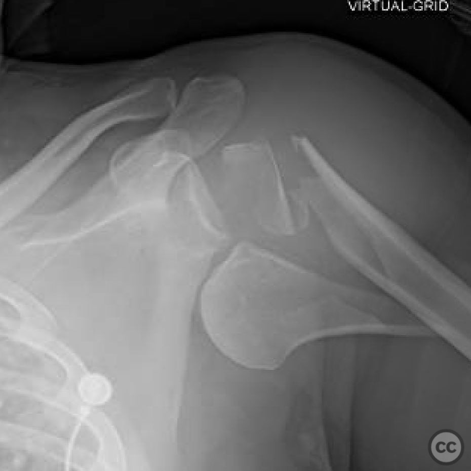case image