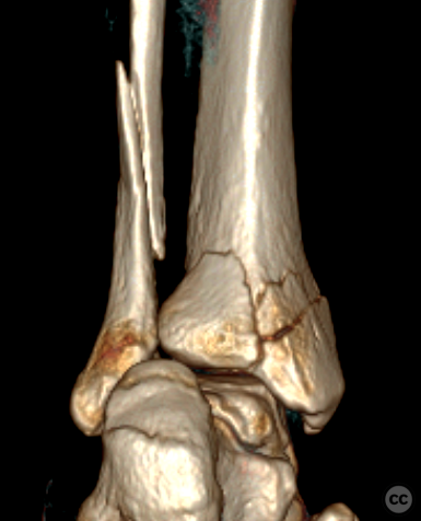 case image