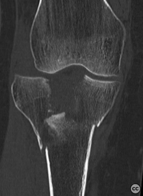 case image