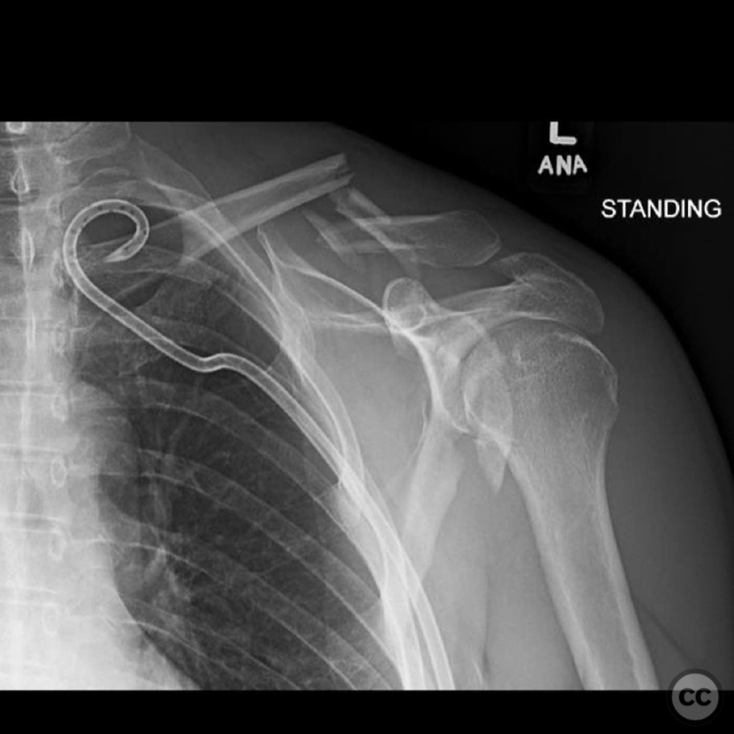 case image