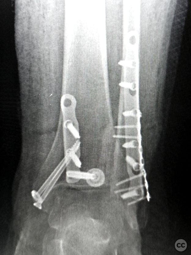 case image