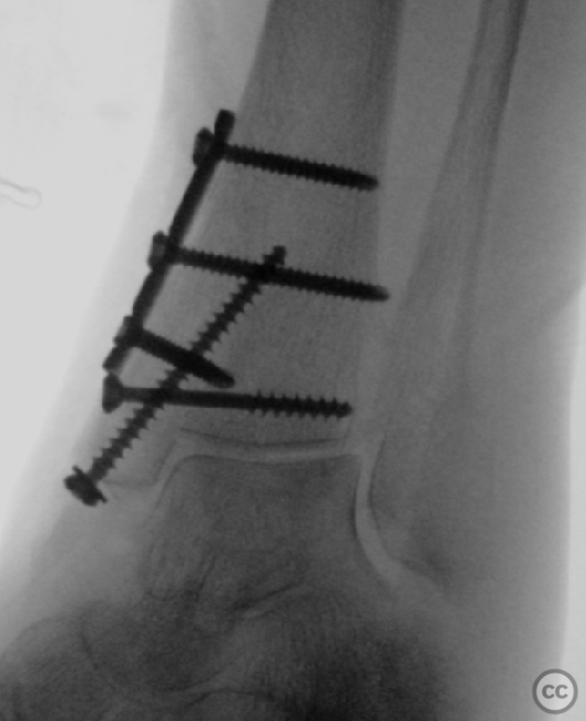 case image