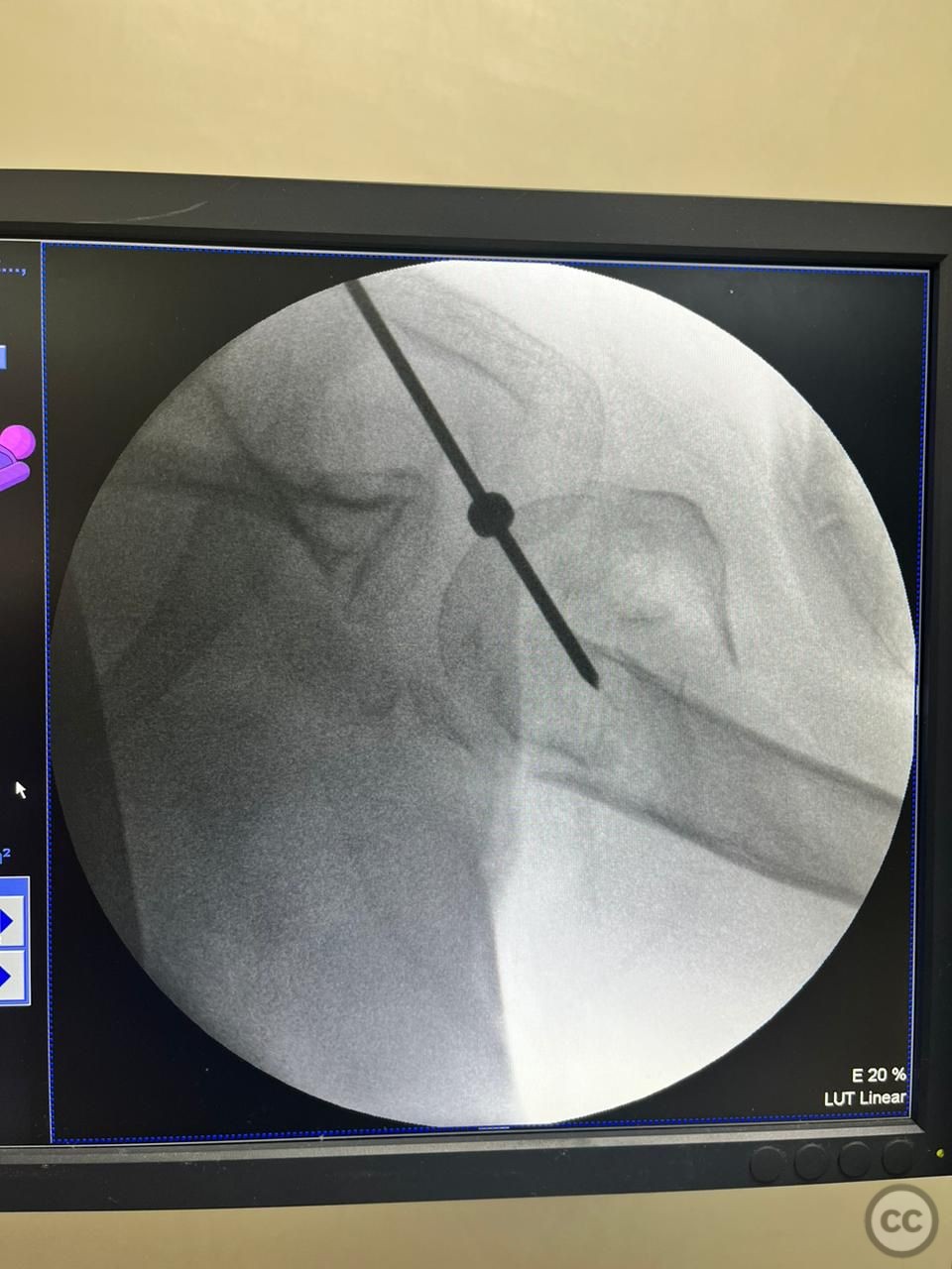 case image