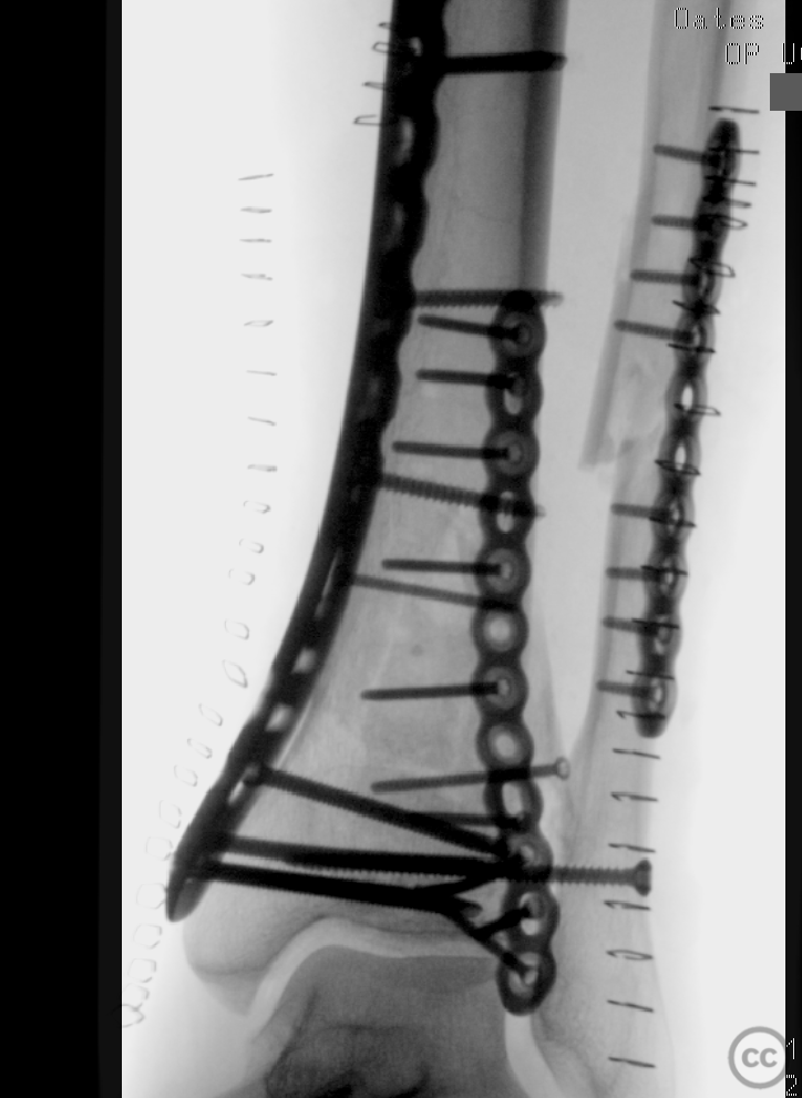 case image