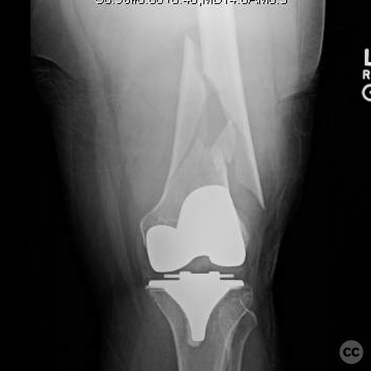 case image