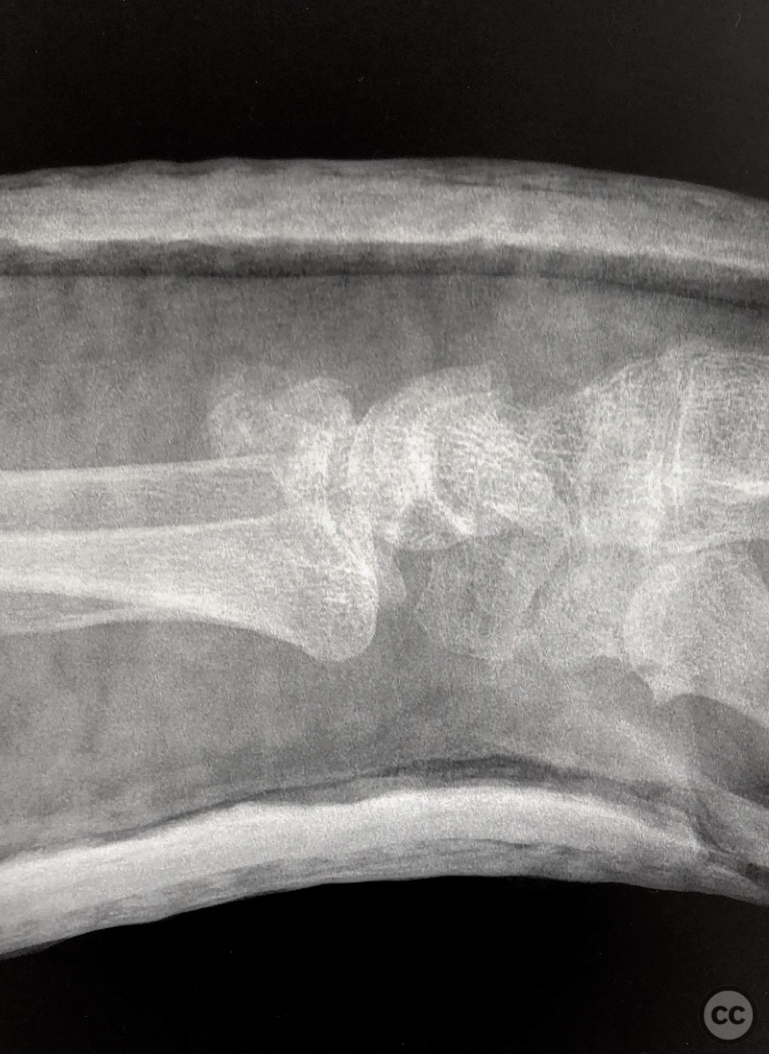 case image
