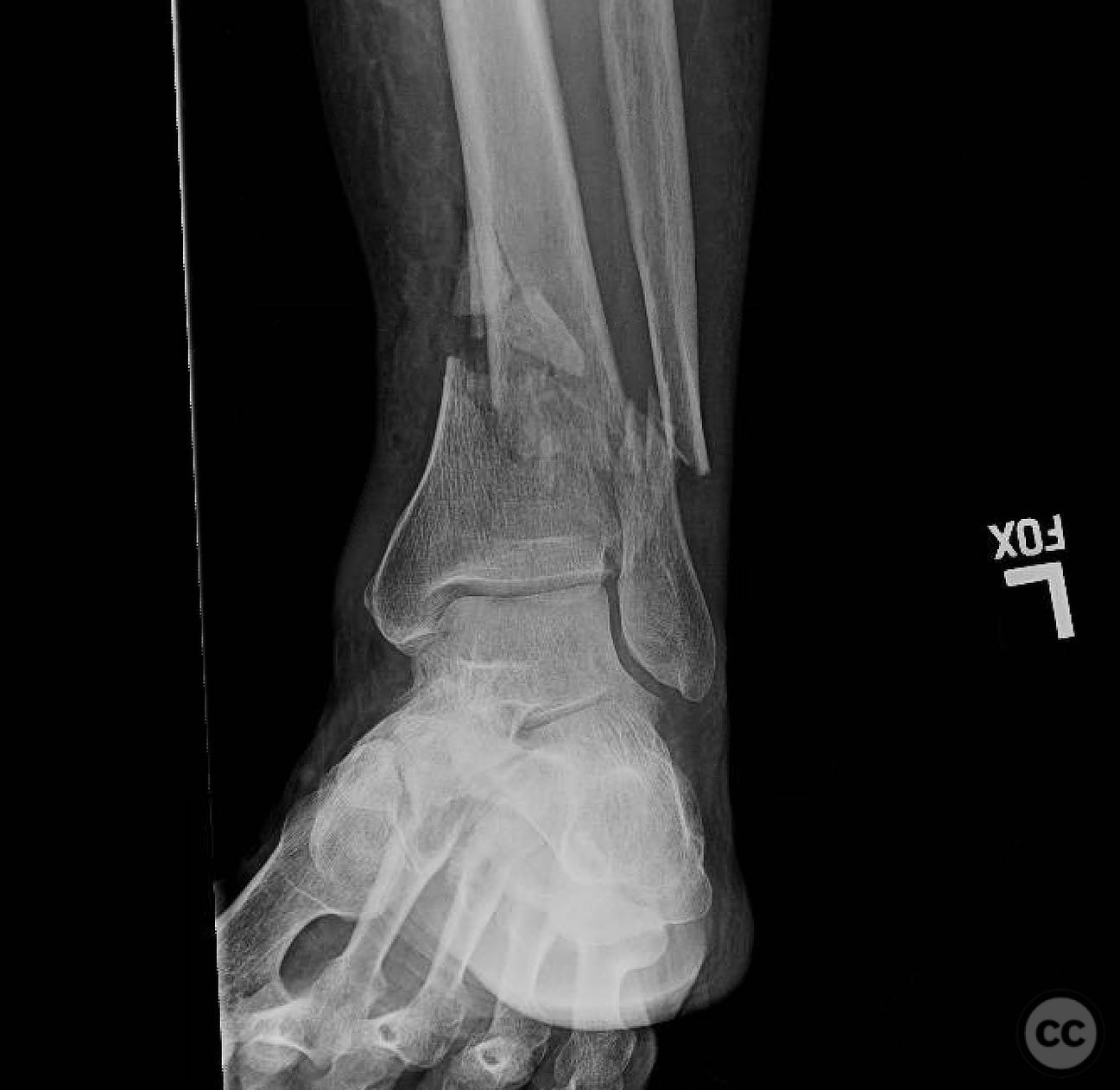 case image