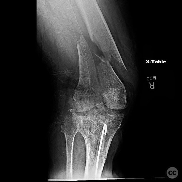 case image