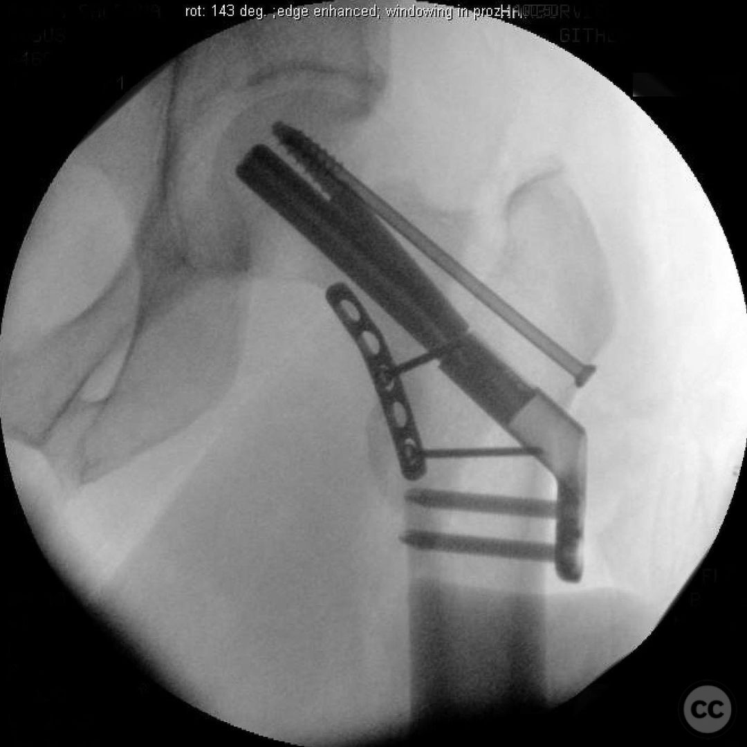 case image