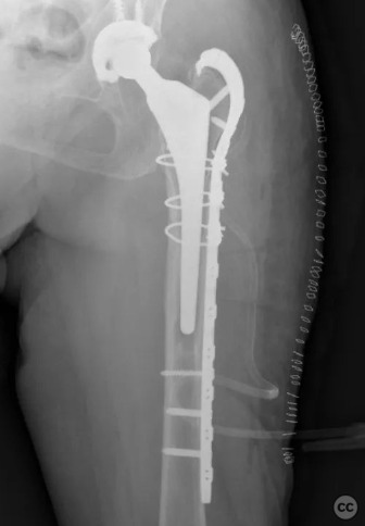 case image