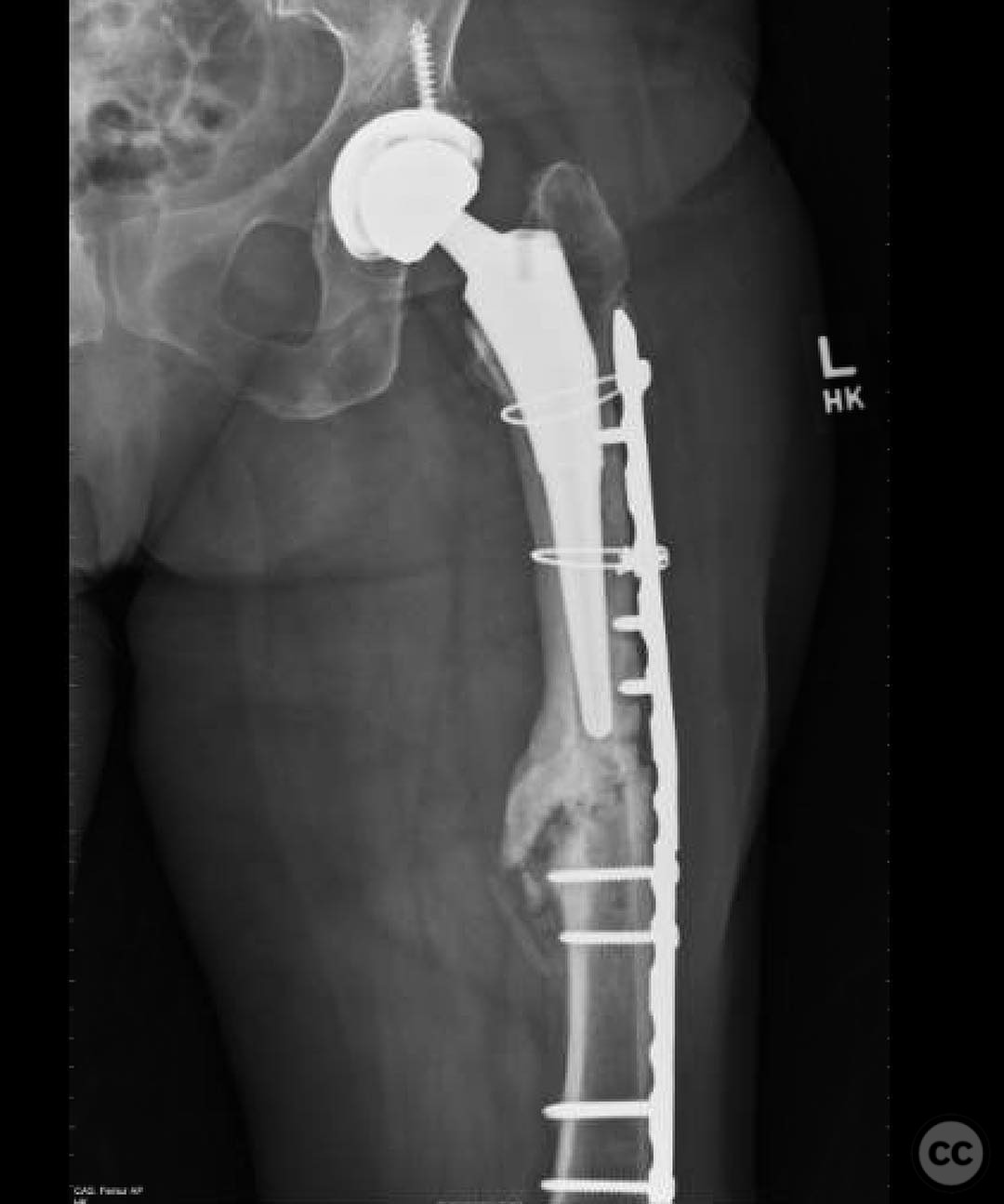 case image