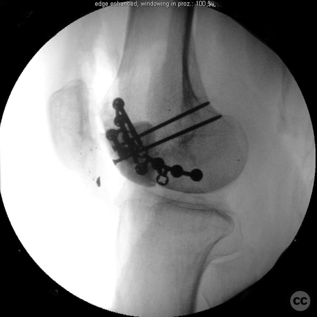 case image