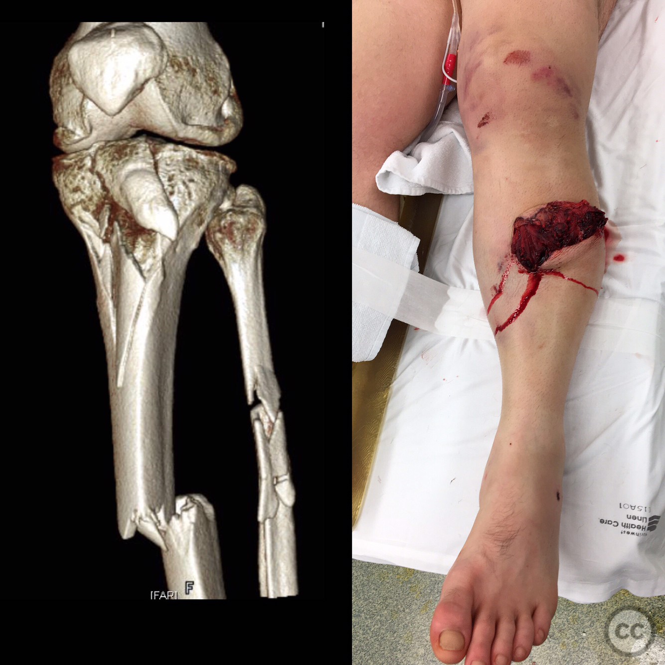 case image