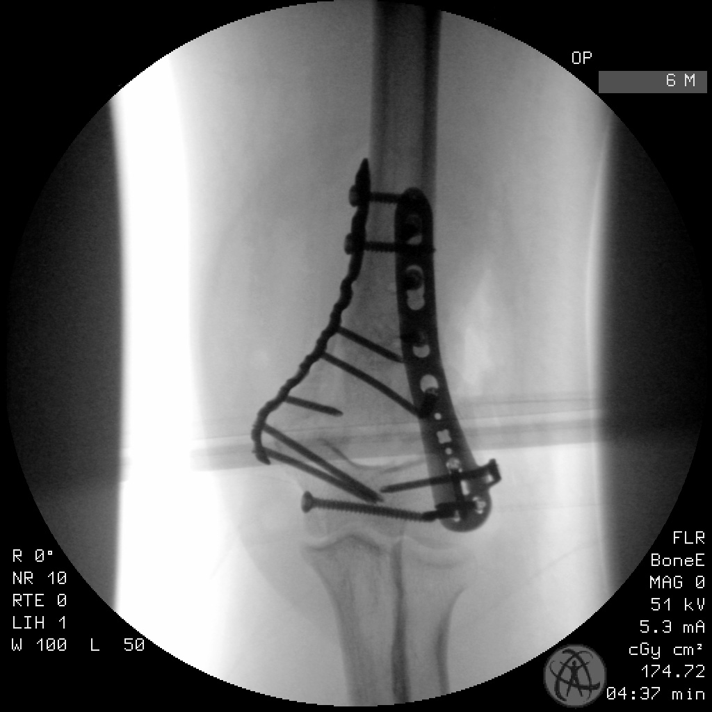 case image