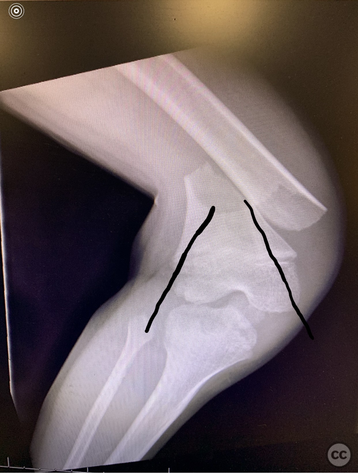 case image