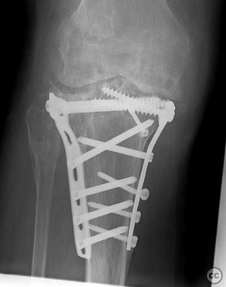 case image