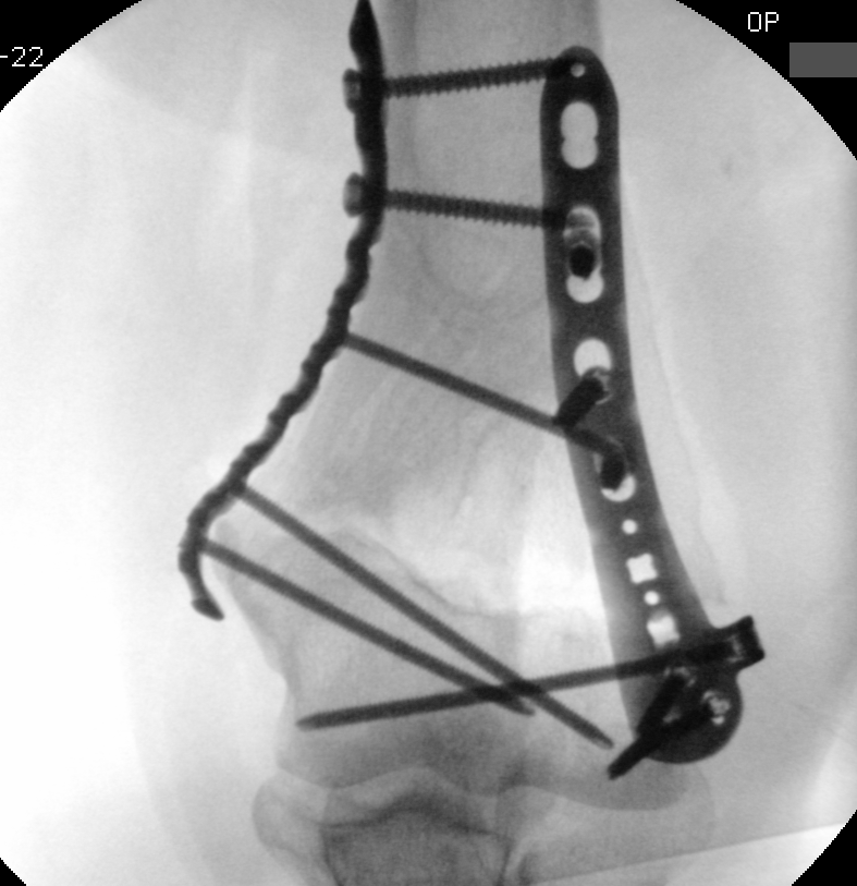 case image