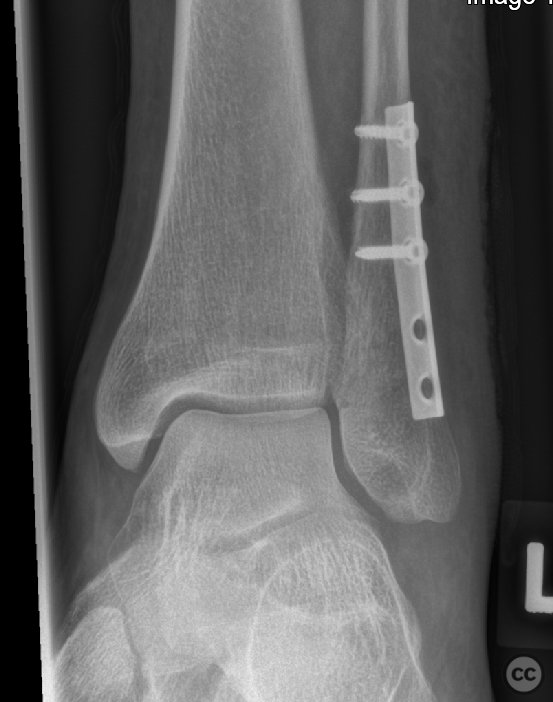 case image