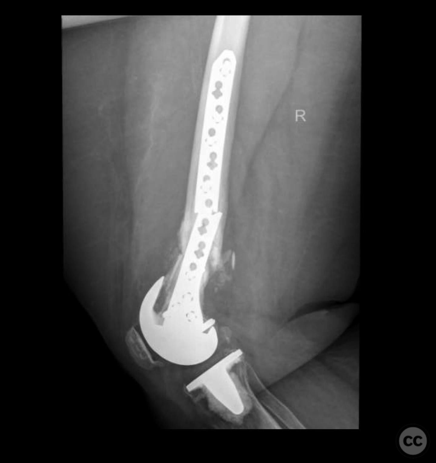 case image