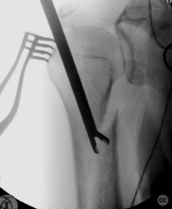 case image