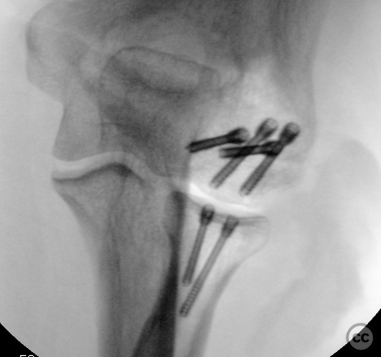 case image
