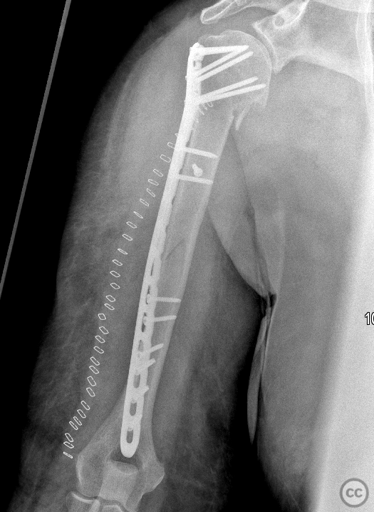 case image