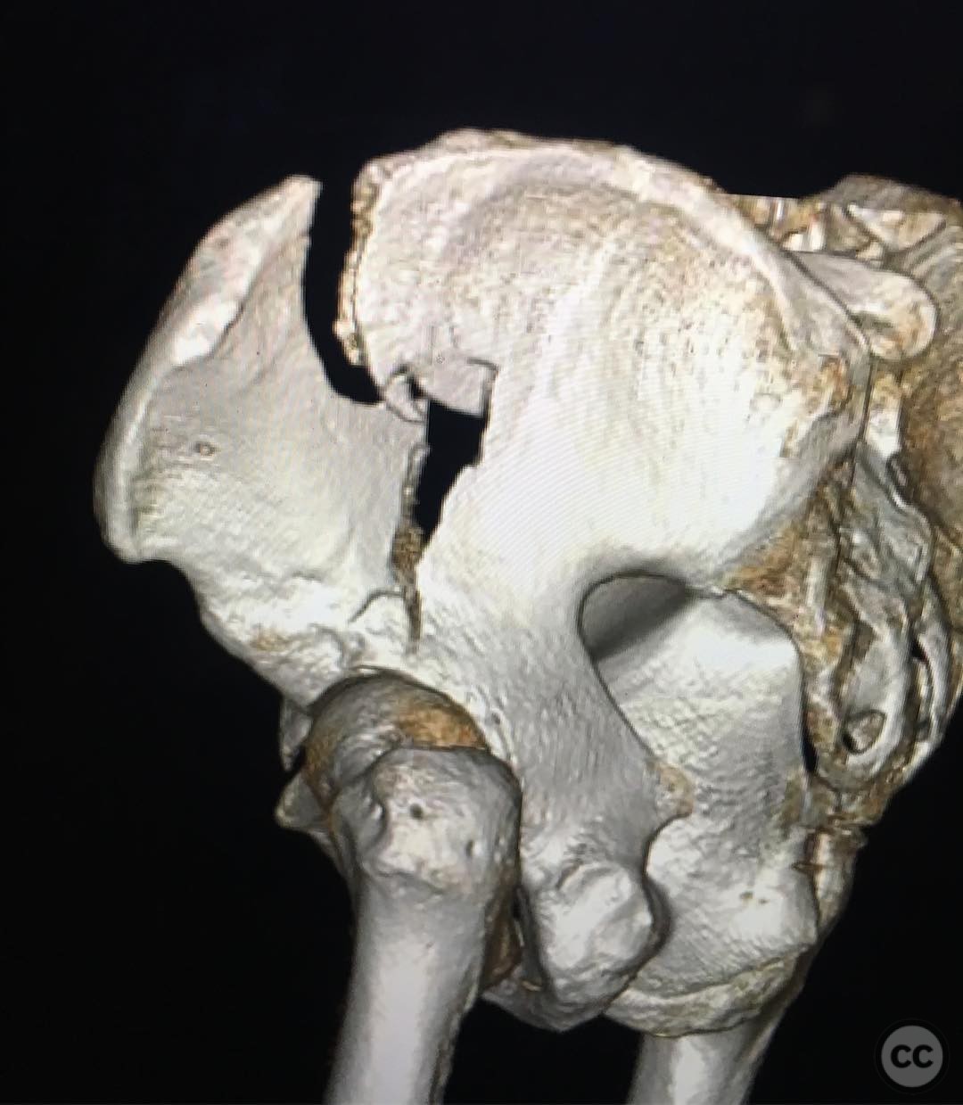 case image