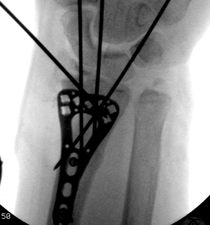 case image