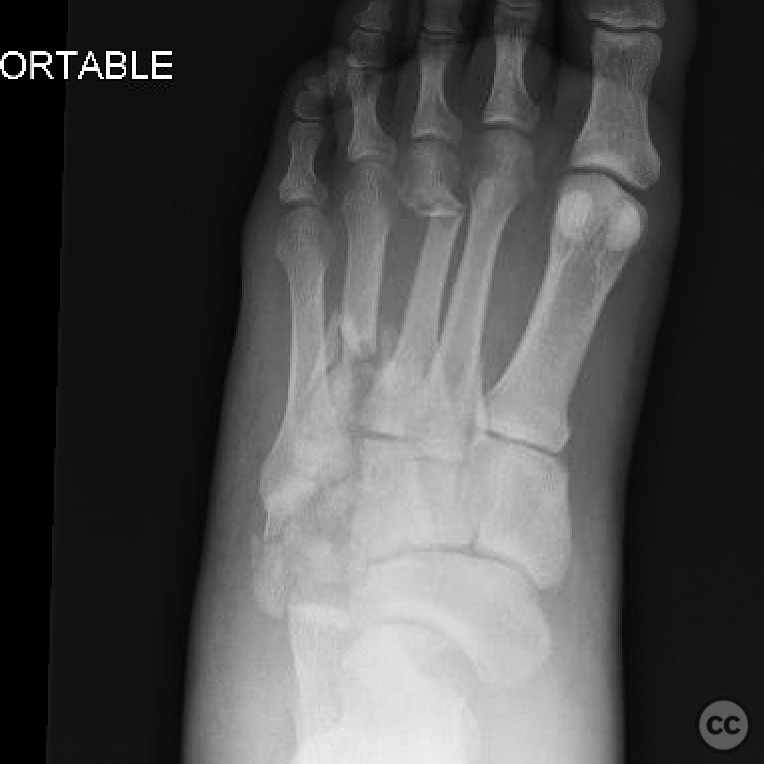 case image