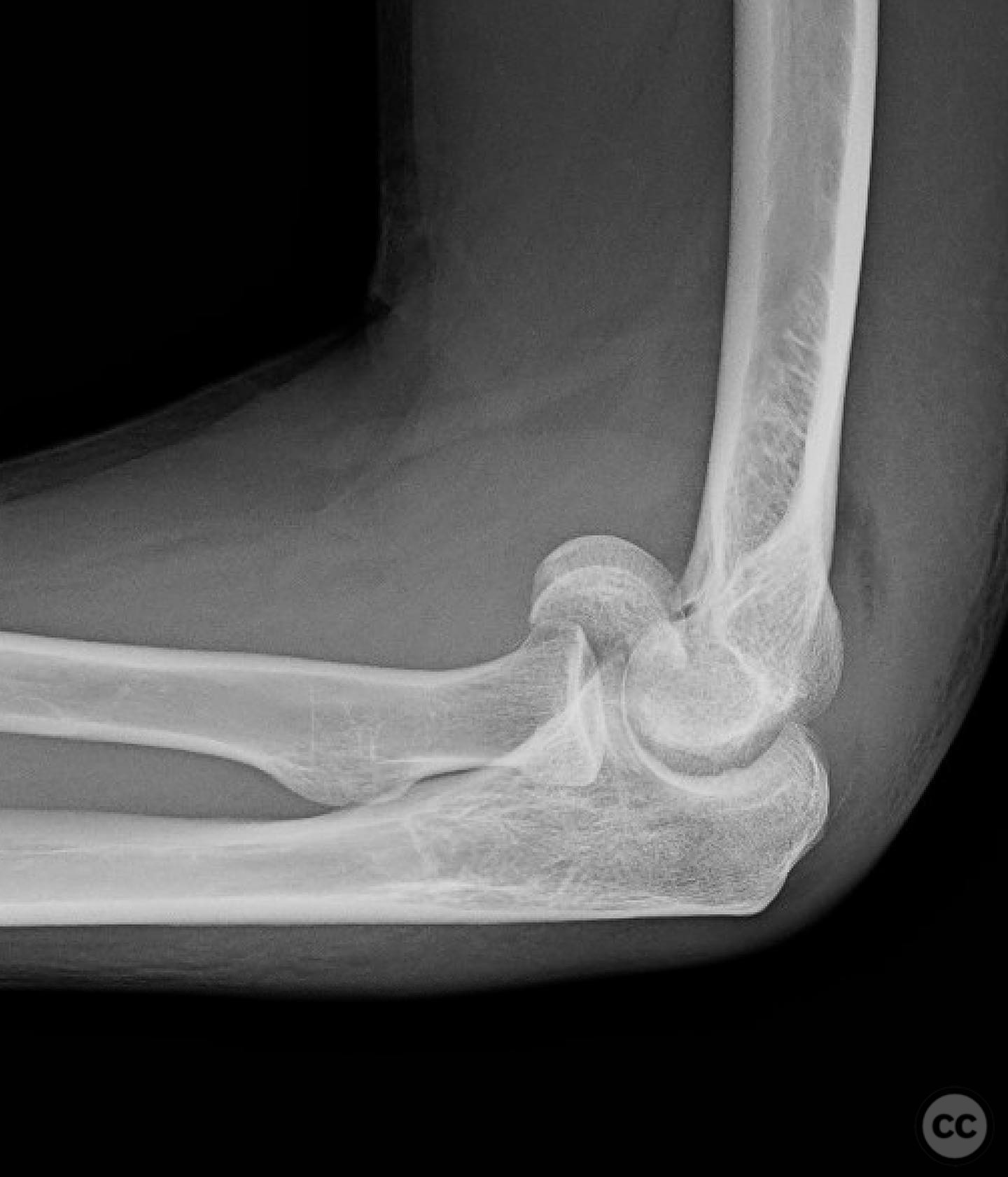 case image