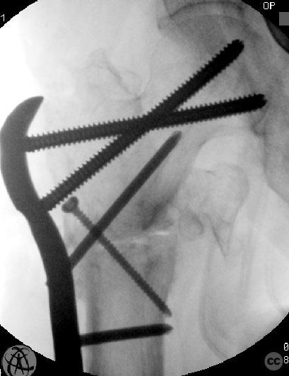case image