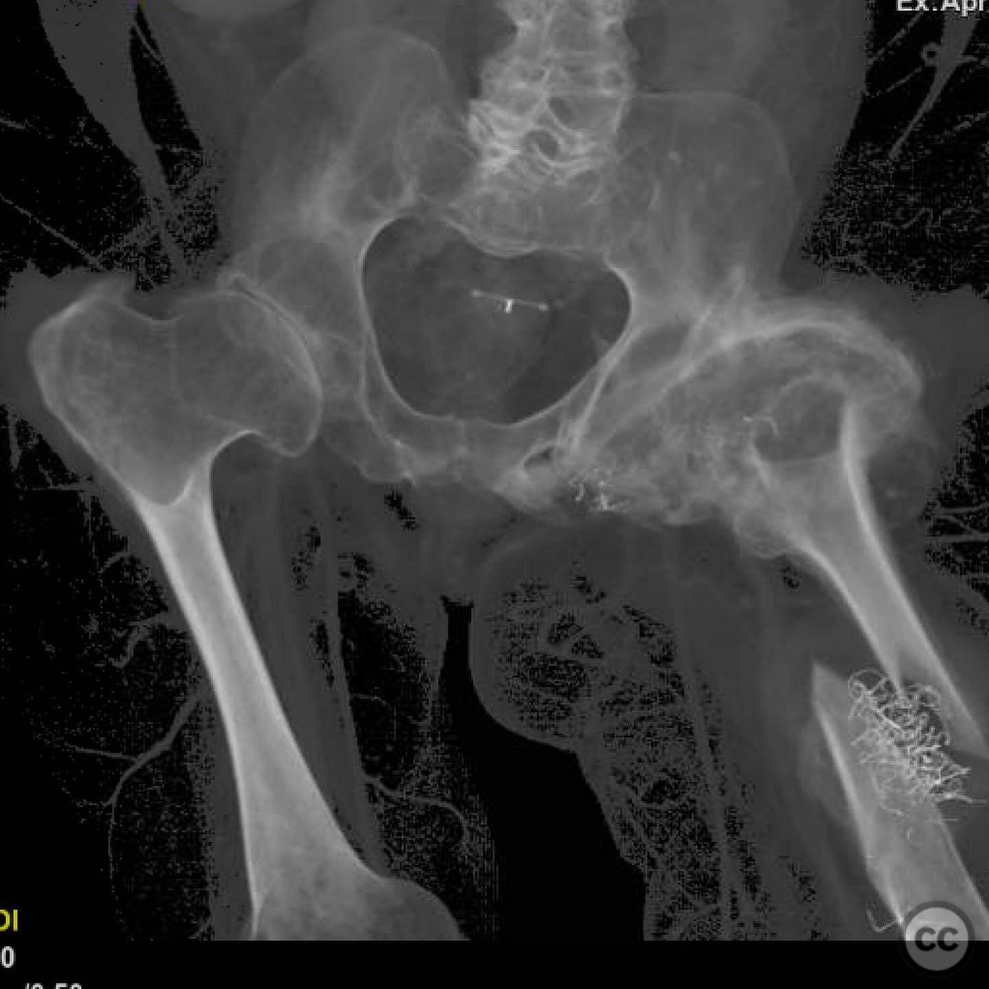 case image