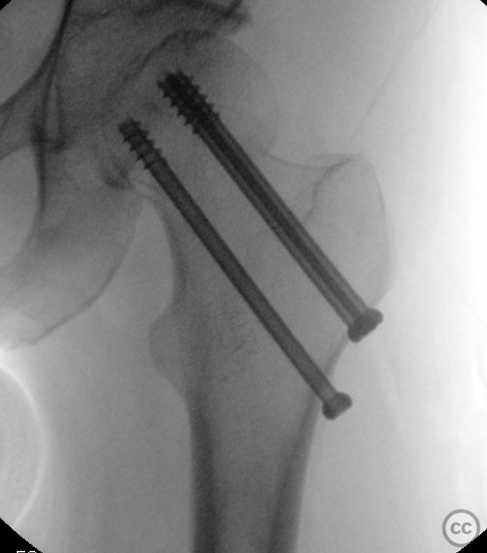 case image