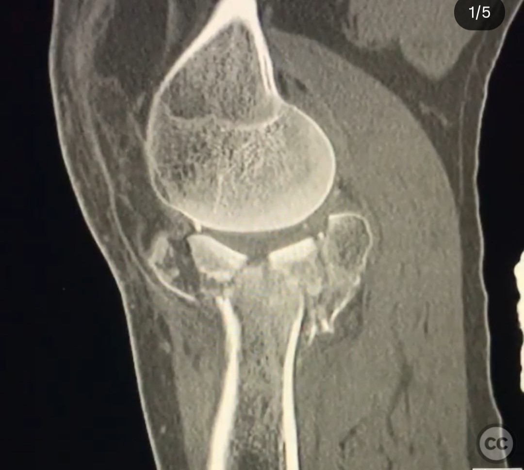 case image