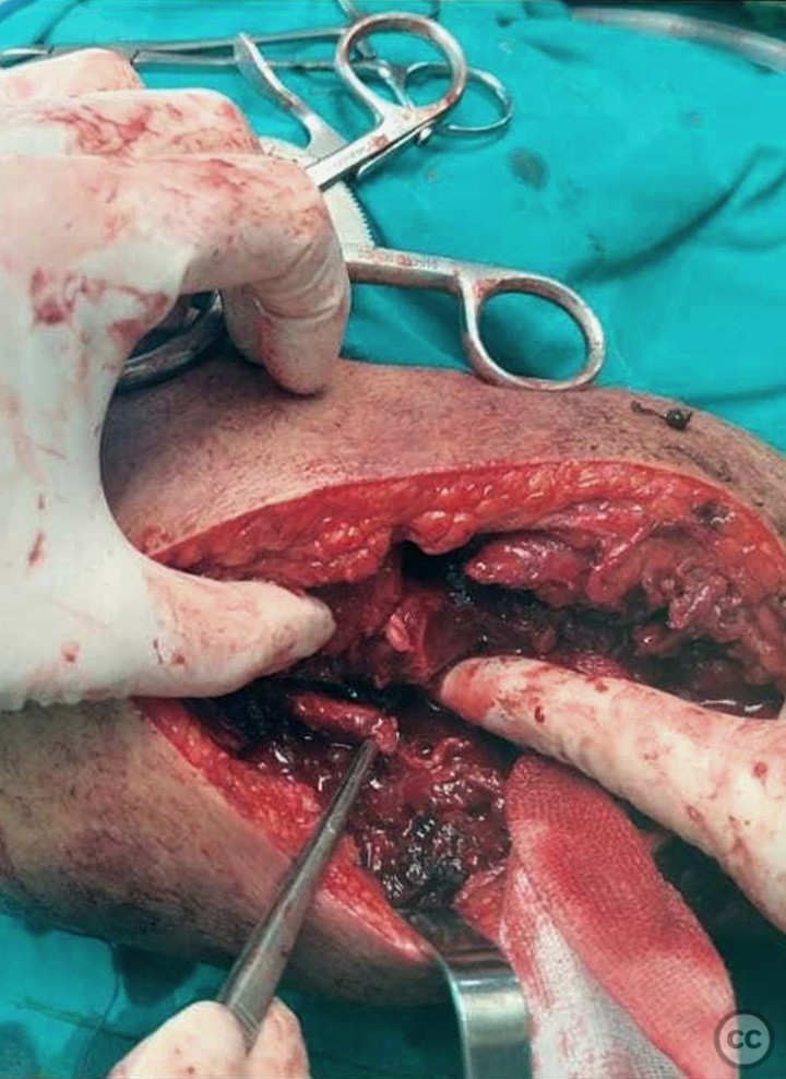 case image
