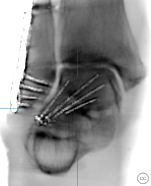 case image