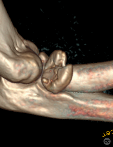 case image