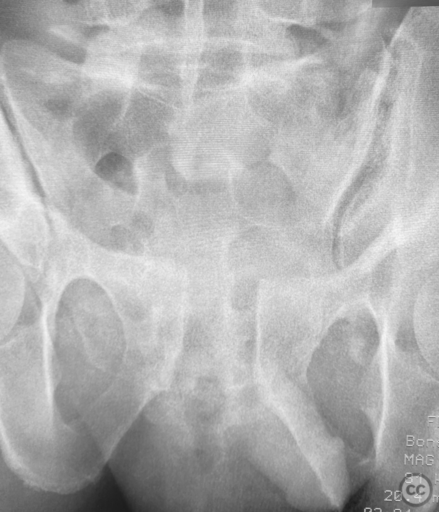 case image