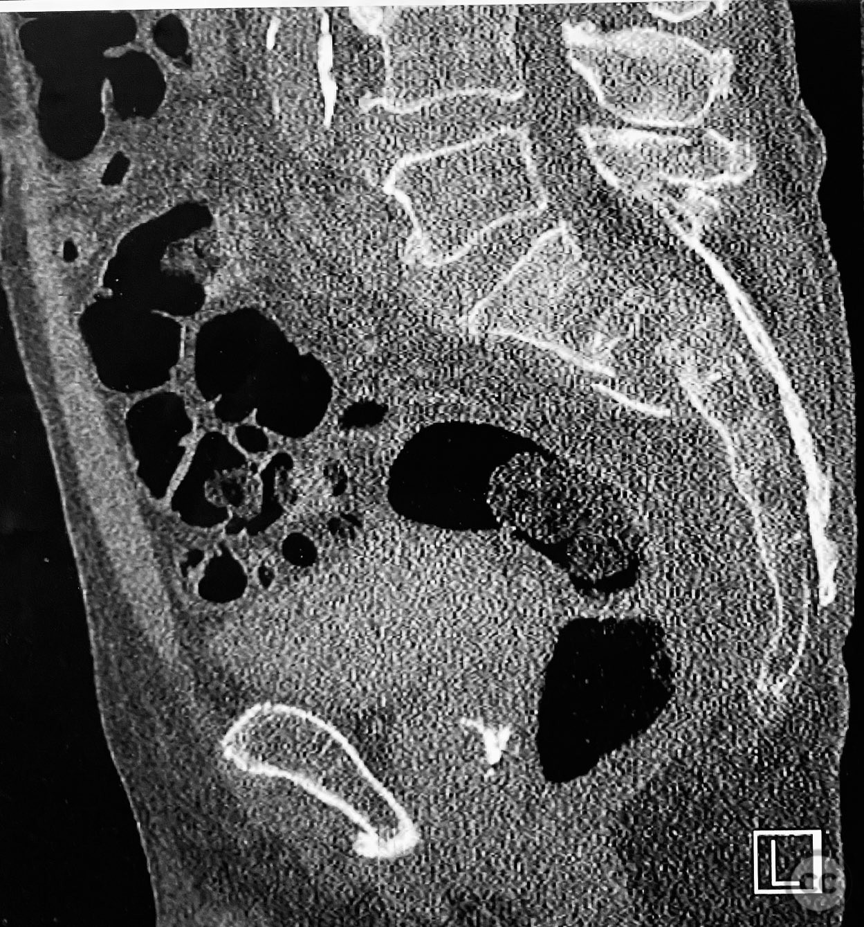 case image