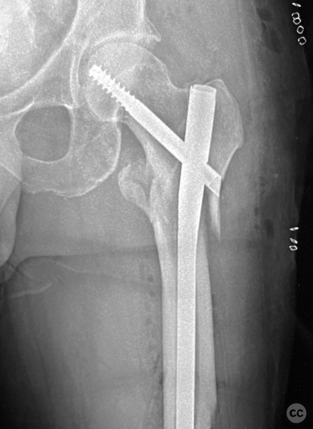 case image